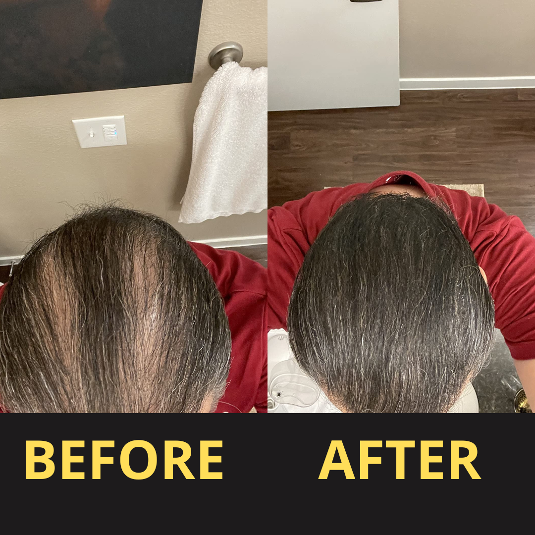 HairGent Siyah Saç Kapatıcı – Suya Dayanıklı, 3–7 Gün Etkili