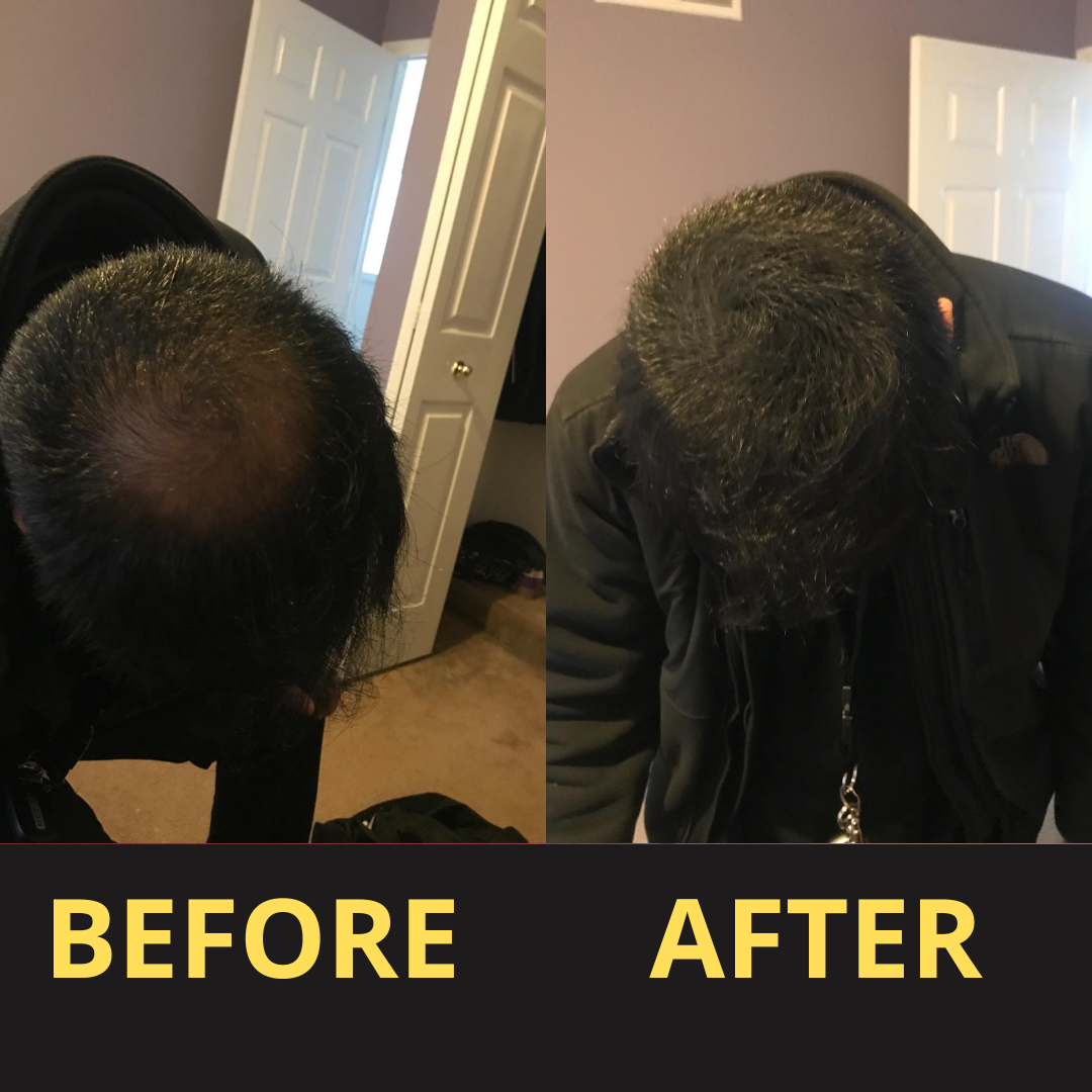 HairGent Siyah Saç Kapatıcı – Suya Dayanıklı, 3–7 Gün Etkili