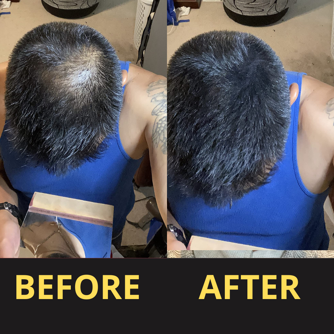 HairGent Siyah Saç Kapatıcı – Suya Dayanıklı, 3–7 Gün Etkili