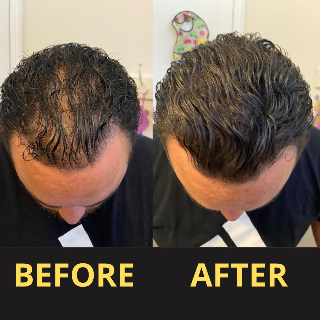 HairGent Siyah Saç Kapatıcı – Suya Dayanıklı, 3–7 Gün Etkili