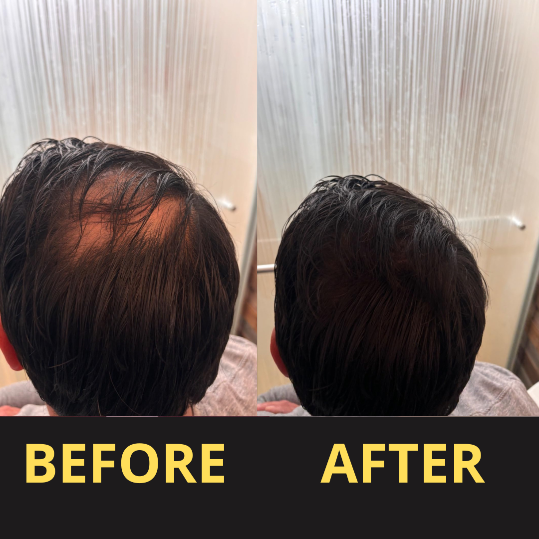 HairGent Siyah Saç Kapatıcı – Suya Dayanıklı, 3–7 Gün Etkili