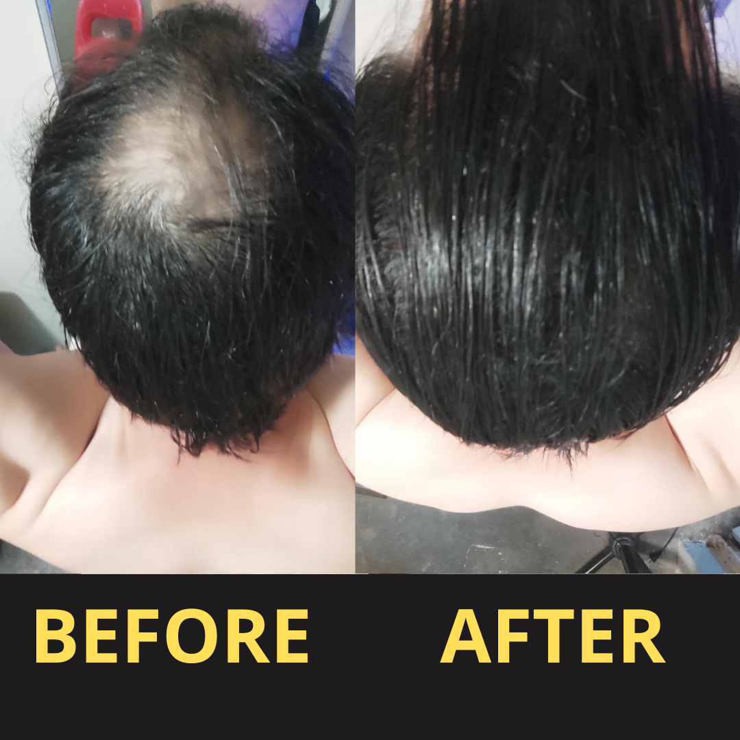 HairGent Siyah Saç Kapatıcı – Suya Dayanıklı, 3–7 Gün Etkili