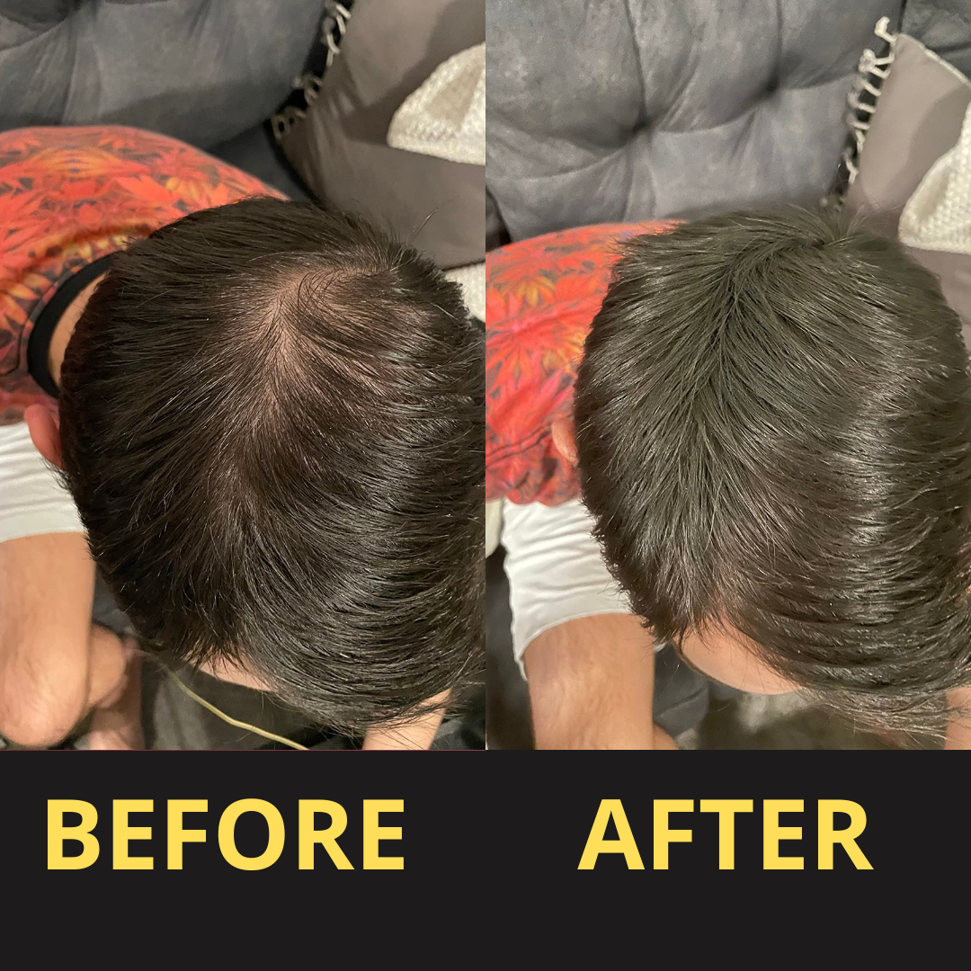 HairGent Siyah Saç Kapatıcı – Suya Dayanıklı, 3–7 Gün Etkili