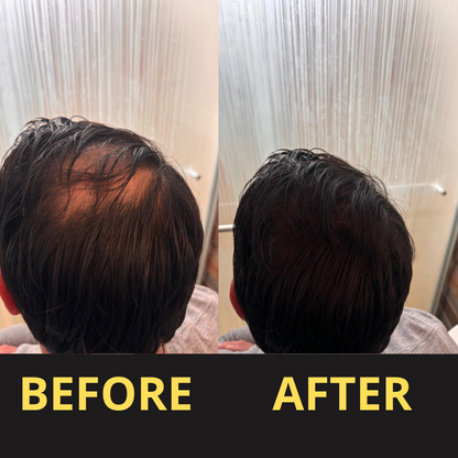 HairGent Siyah Saç Kapatıcı – Suya Dayanıklı, 3–7 Gün Etkili