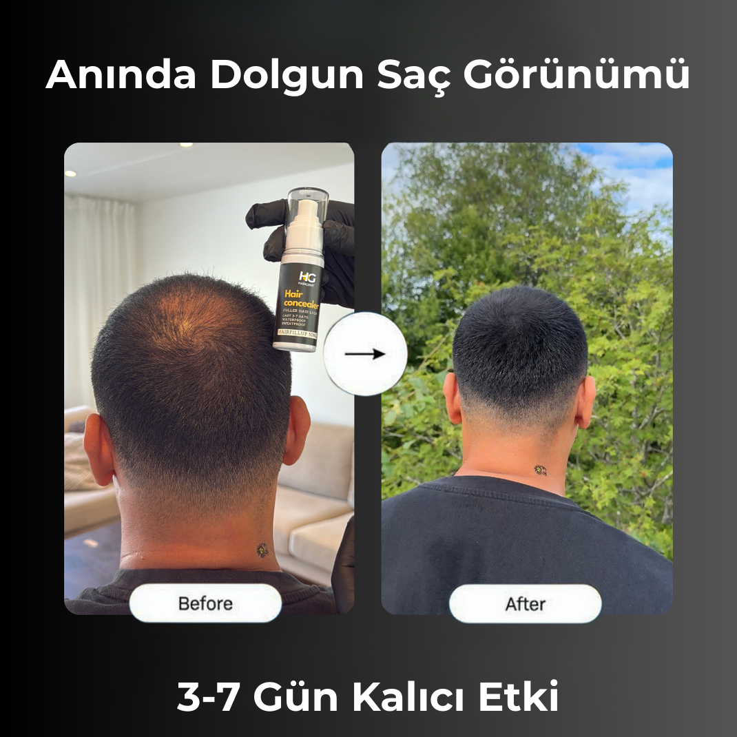 HairGent Siyah Saç Kapatıcı – Suya Dayanıklı, 3–7 Gün Etkili